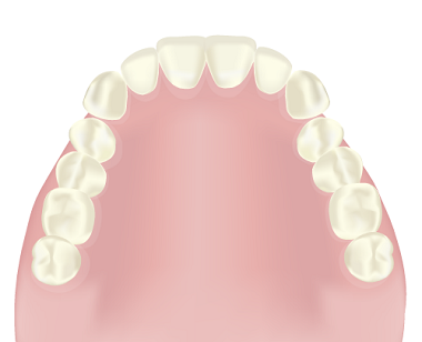 レジン床義歯の特徴