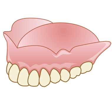 コンフォート義歯の特徴
